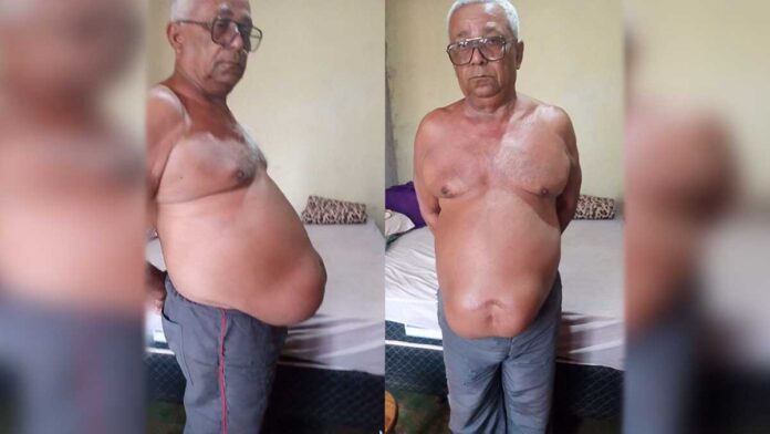 Família arrecada brindes para bingo beneficente para cirurgia de hérnia de tratorista em Terenos