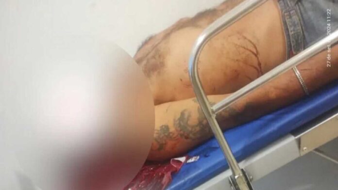 Levando dinheiro aos filhos, homem é atacado com tijolada pelo atual da ex em Três Lagoas