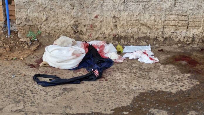 Sobrinha acredita que assassinato em briga por casaco na Nhanhá foi planejada