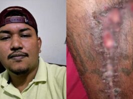 Jovem com tumor na perna faz rifa para ajudar no tratamento em Sidrolândia