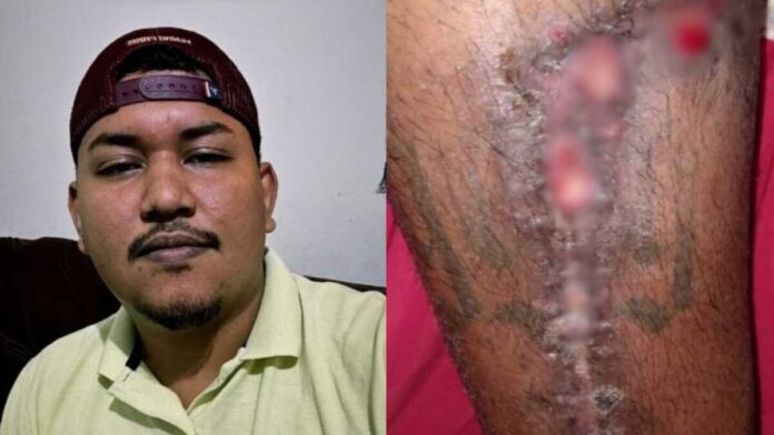 Jovem com tumor na perna faz rifa para ajudar no tratamento em Sidrolândia