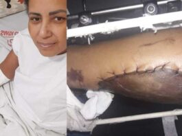 Sem prótese adequada para sua idade, paciente aguarda cirurgia no quadril pela Santa Casa