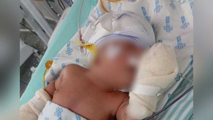 Bebês vieram com malformação grave e mãe apela por Davi e Saulo em Maracaju